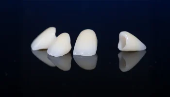 Signs You May Need a Dental Crown According to St. Michael Dentists