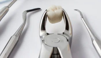When Is a Tooth Extraction Necessary?