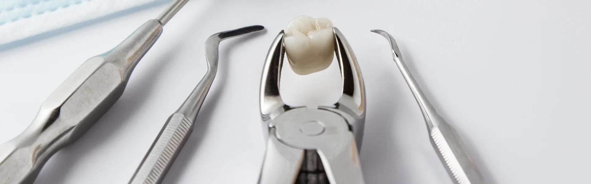 When-Is-a-Tooth-Extraction-Necessary